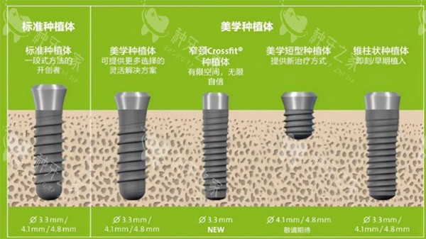 种植体规格种类参考图