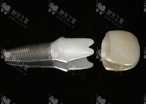 常熟种牙价格多少？韩系植体2800元起！