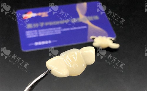PROHPP聚合瓷粘接桥