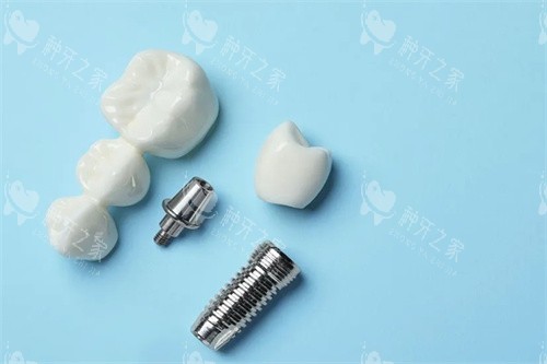 种植牙才2980元靠谱吗？种牙价格必须参考三个标准