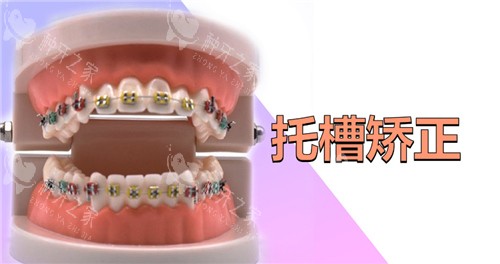 托槽矫正图
