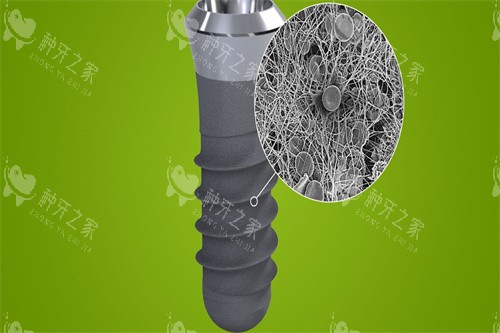 种植牙模型示意图