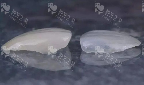 瓷贴面修复对比