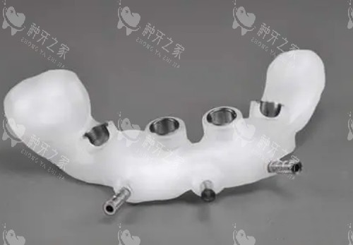 导板种植牙术后3年：如何缩短改善期？