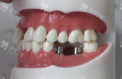 高淳正规的种牙医院分享：这九家价不贵口碑好