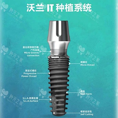 韩国沃兰和奥齿泰哪个好？从植体特点/价格等进行对比