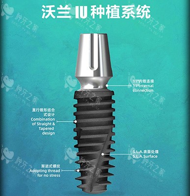 韩国沃兰种植牙是什么档次？价格多少钱？能用多少年？