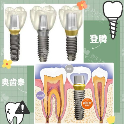 登腾奥齿泰动画图