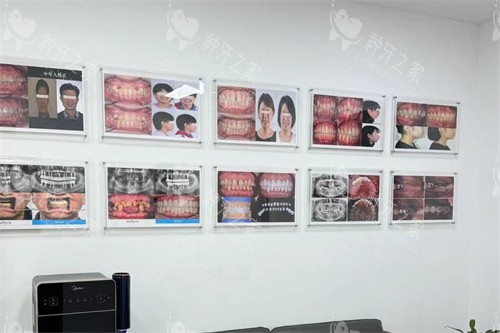 沈阳全家口腔病例展示