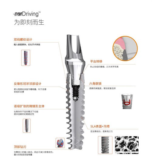 国产百齿泰植体价格表,费用透明化
