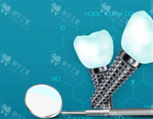 丽水种植牙少钱价格表:进口3580+全口7万+