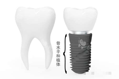 2025年麦芽口腔医院种植牙价格大公开！