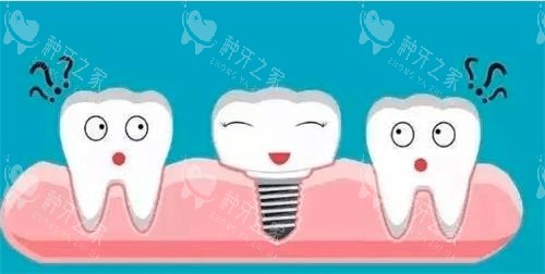 宜兴城东口腔种植牙怎么样？价格透明无隐形消费！