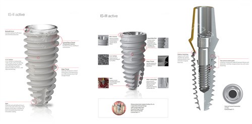 纽百特种植体纯钛等级解析：四级钛强度850Mpa！