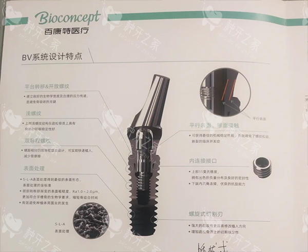 百康特种植牙好不好
