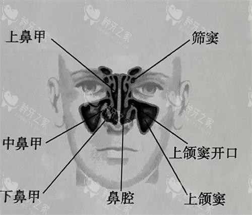 鼻部结构组织上颌窦等位置示意图