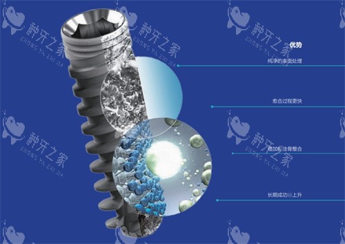 以色列雅定种植体 16800，高性价比背后的真相！