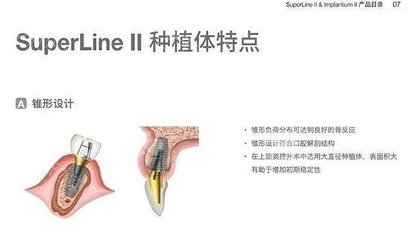 登腾二代种植体特色图片