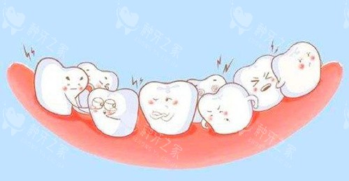 牙齿拥挤动画