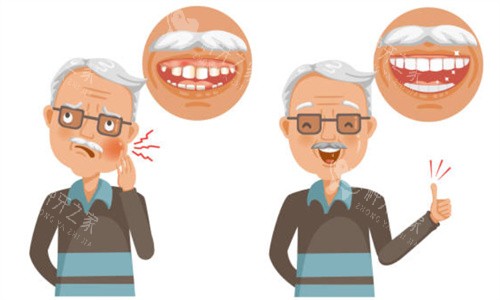 70岁以上老人种牙后果？注意事项解析