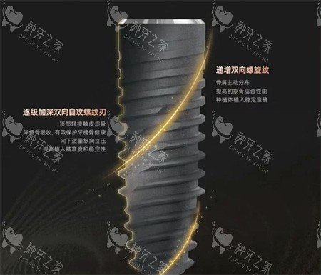 卡尔斯种植牙种植体螺纹照片