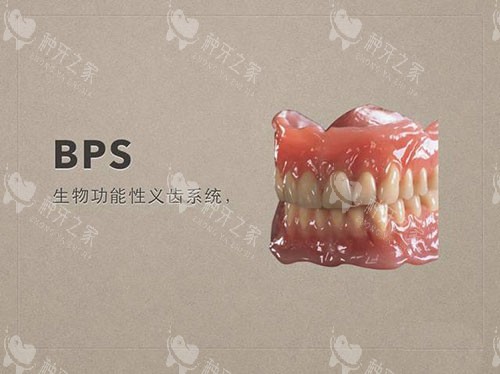 牙齿义齿吸附性义齿示意图