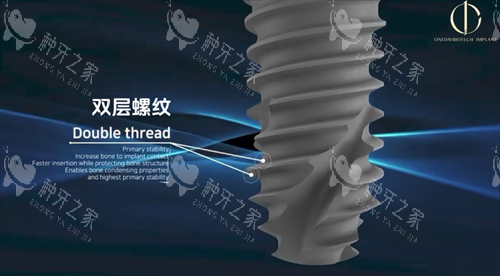 韩一种植体螺纹设计