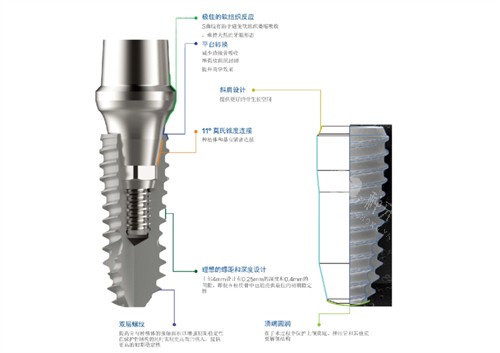 韩一种植体S系列简介