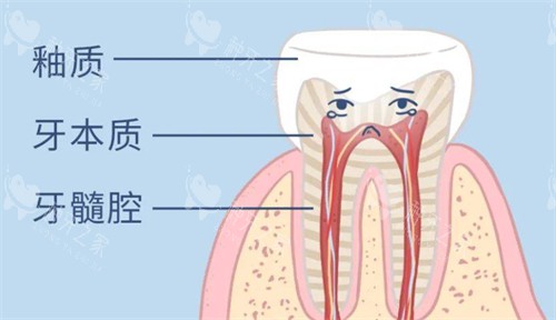 牙齿变黄怎么办