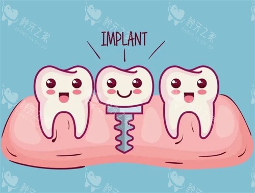 种植牙漫画示意图 种植牙漫画示意图