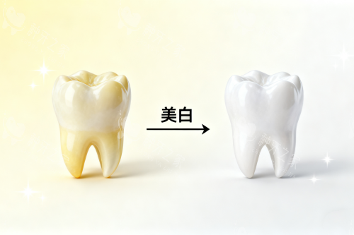 牙齿美白对比图一览 牙齿美白对比图一览