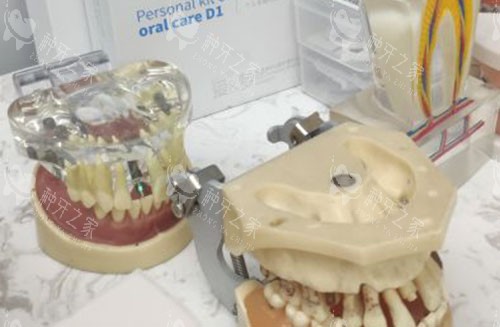 防城港健安口腔牙齿模型展示 防城港健安口腔牙齿模型展示