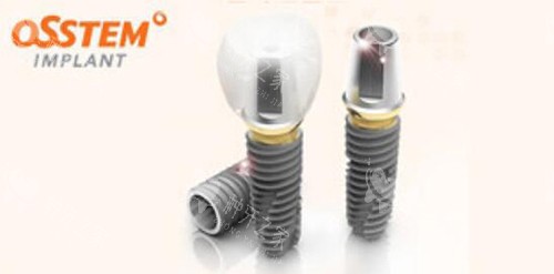 奥齿泰种植牙材料照片 奥齿泰种植牙材料照片