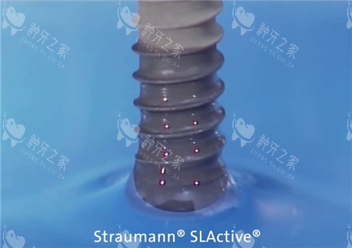 士卓曼BLX种植体价格揭秘:钛锆合金抗折力超强?