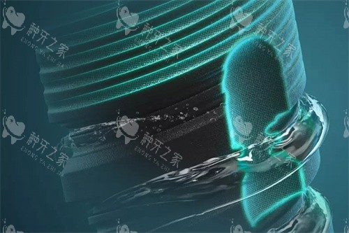 德国ABT种植牙削切槽设计 德国ABT种植牙削切槽设计