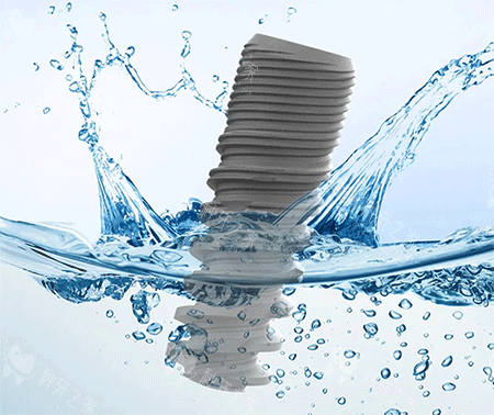 科惠种植牙怎么样 科惠种植牙怎么样