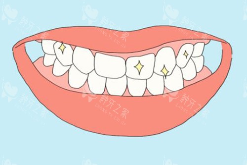 牙齿美白改善图展示 牙齿美白改善图展示