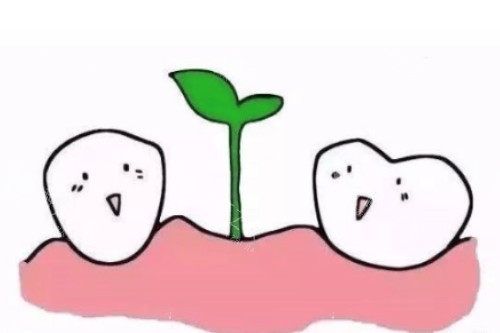 普鲁士种植牙好不好用？德国工艺+98.8%咬合力