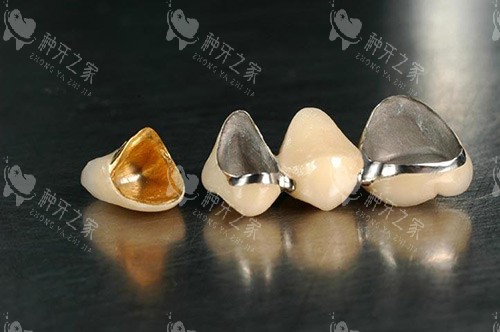 全瓷牙冠材料展示 全瓷牙冠材料展示