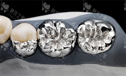 烤瓷牙素材图片 烤瓷牙素材图片