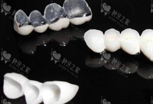不同种类烤瓷牙模型展示 不同种类烤瓷牙模型展示