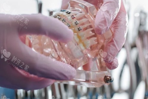 牙齿模型参考图 牙齿模型参考图