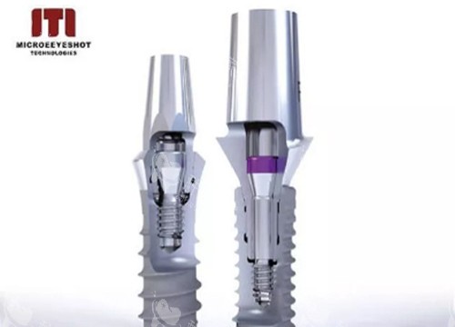 瑞士ITI种植体示意图1 瑞士ITI种植体示意图1