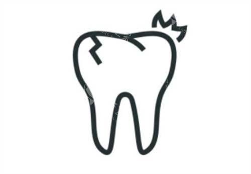 种植牙牙裂示意图 种植牙牙裂示意图