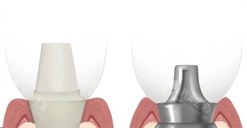 南宁微美口腔种植牙价格表:南湖名都旁,环境舒适