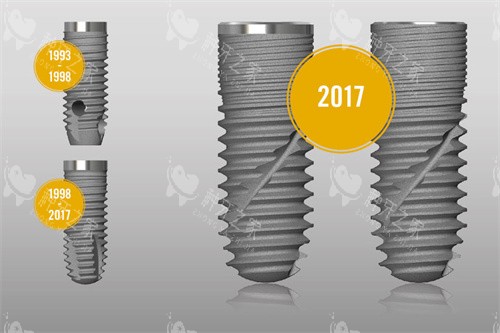 德国贝格种植系统5大特点：SLA表面处理+自攻螺纹