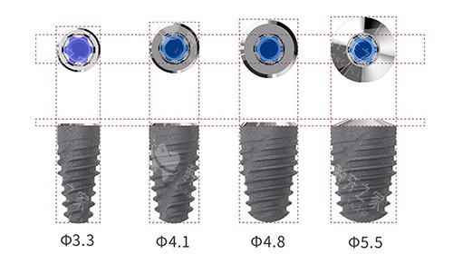 卡尔斯种植牙植体型号 卡尔斯种植牙植体型号