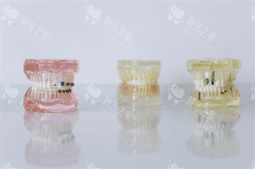 保山训斌口腔价格表：种植牙3800元起！