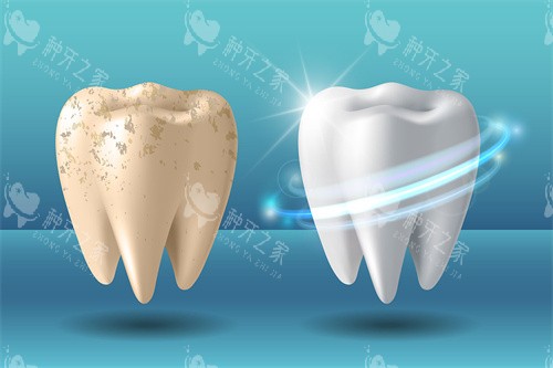 牙齿美白前后差异 牙齿美白前后差异