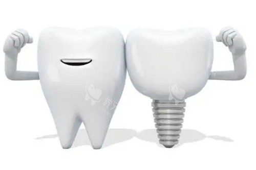 郑州金水区种植牙怎么选?聊聊这几家有实力